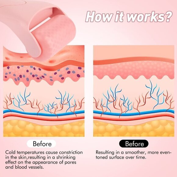 Ice Roller for face, Under Eyes, Body!  Therapeutic Cooling to Tighten Brighten - Picture 3 of 5